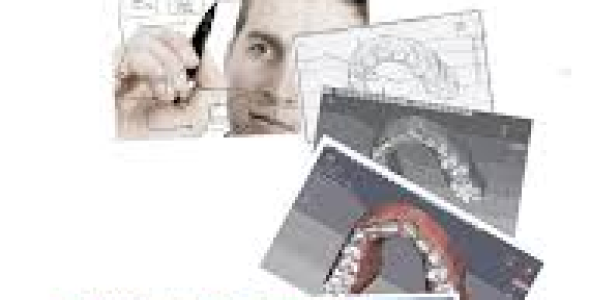 iROK OrthoRx 6.2 (Orthodontic Planning Software) Download