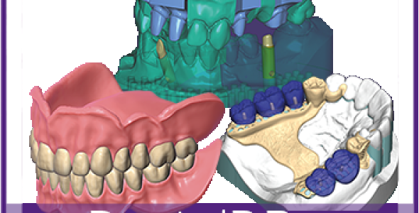 Exocad DentalDB + Partialcad 3.3 Chemnitz Builld 665 By TeamArman